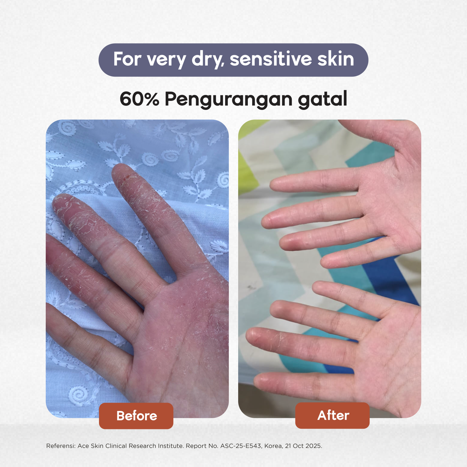 Intensive Barrier Repair Lotion