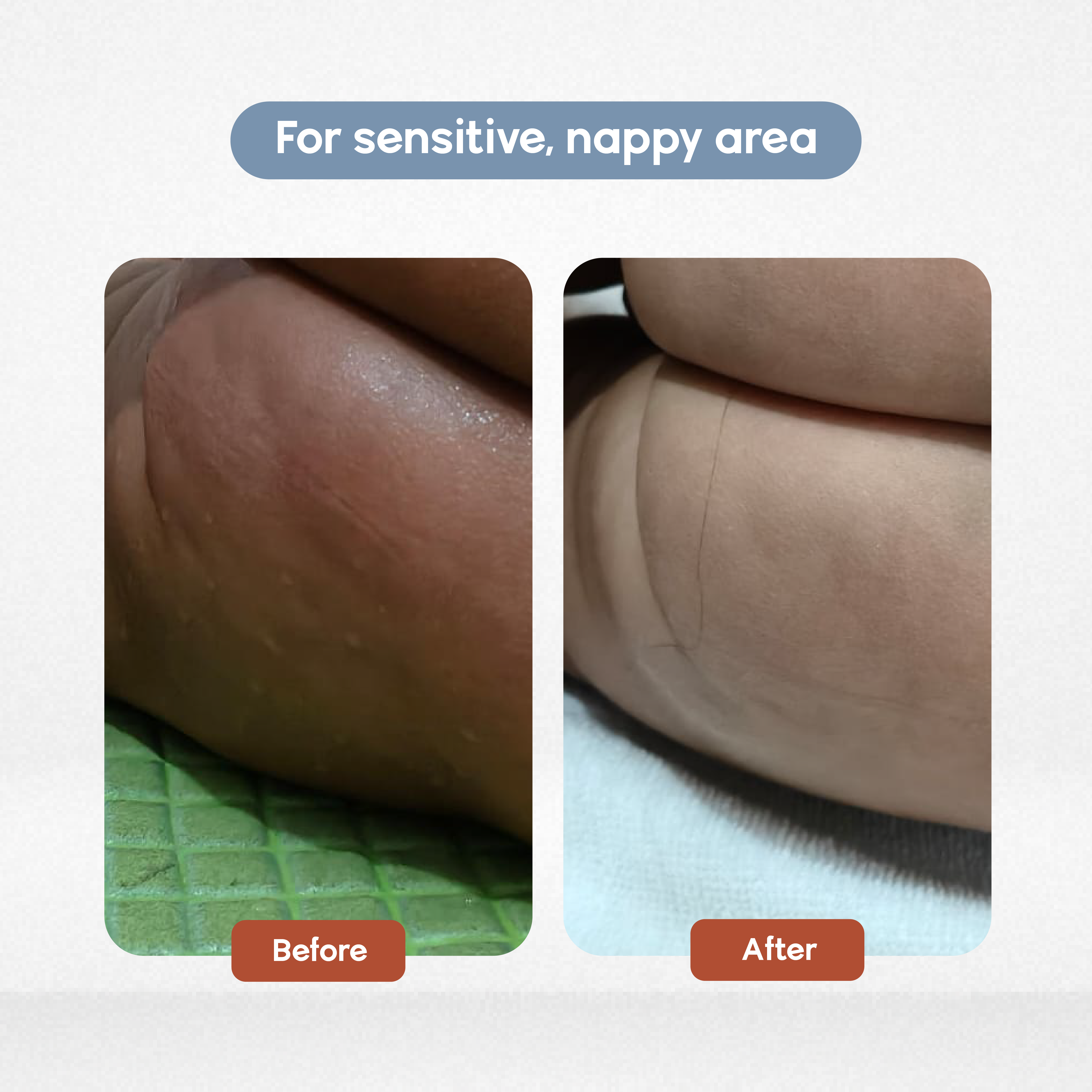 Daily Nappy Barrier Cream